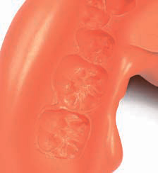 Zhermack Неоколлойд - оттиск